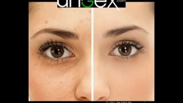 The best solution for remove demodex смотреть онлайн