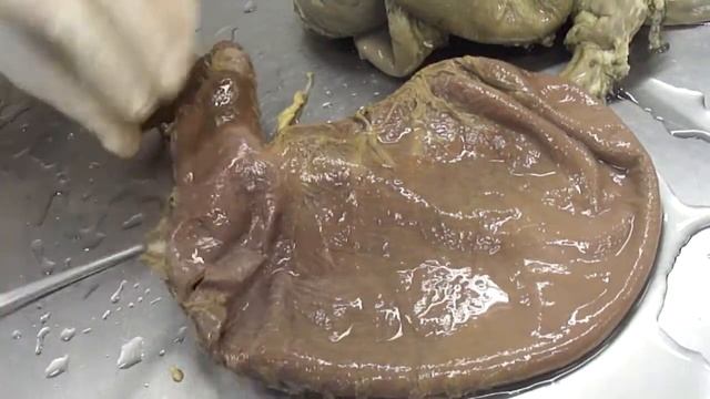 Anatomia 005 смотреть онлайн