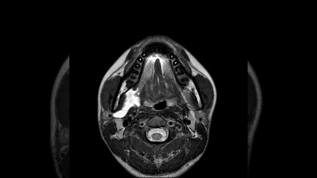 HN C6 Uncomplicated LM (A) смотреть онлайн