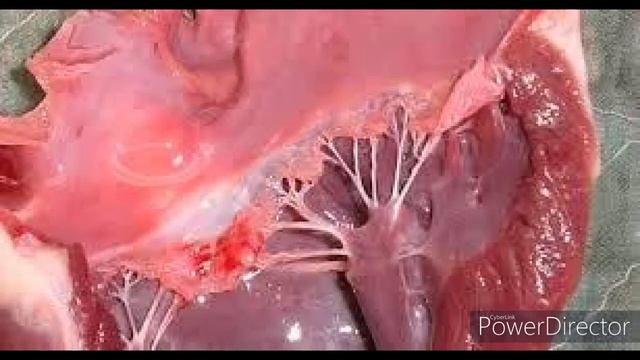 Audio 6-1. Soplo sistólico de regurgitación mitral. смотреть онлайн