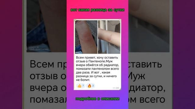 вот такая разница #сибирскоездоровье #пантенол #ожоги #кожа