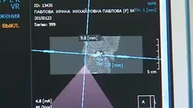 Mira подробно об имплантации зубов в Москве смотреть онлайн