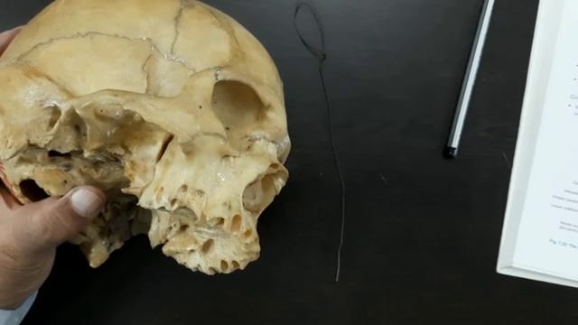 8. Pterygopalatine fossa смотреть онлайн
