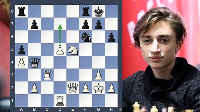 Serangan Posisional Daniil Dubov || Dubov Vs Gukesh
