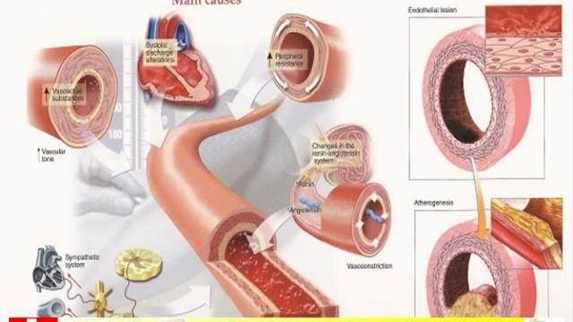 obat darah tinggi tradisiona смотреть онлайн