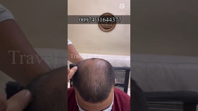 How to use Neo Hair Lotion successfully Malayalam/Original Neo Hair Lotion/എങ്ങിനെ ഉപയോഗിക്കാം смотреть онлайн