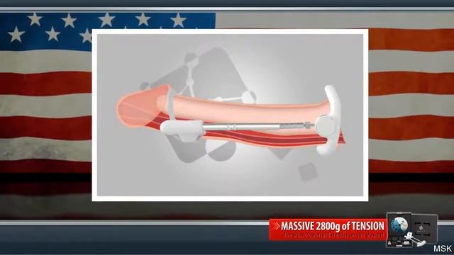 Sizegenetics Results Forum - Can You Wear Sizegenetics While Sleeping смотреть онлайн