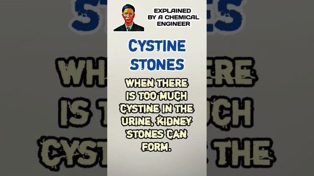 Cystine Kidney Stones (Part 10 - Prevention Of Kidney Stones)
