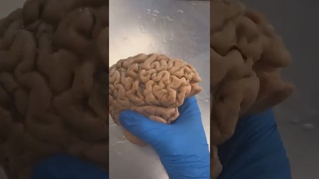 The Brain Of An Irrational Person