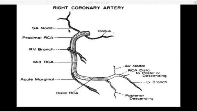 How to Manage Acute Coronary Syndrome in Non PCI Centre? What's The Best We Can Do? смотреть онлайн