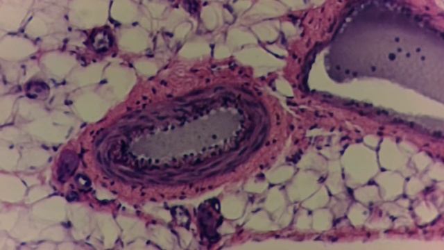 Кровеносные сосуды Arterio venous blood vessel смотреть онлайн