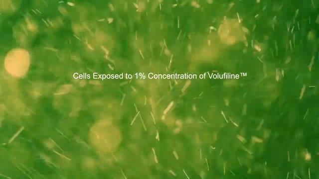SJDKOREA_VOA Intensive Volume Control no.1 смотреть онлайн