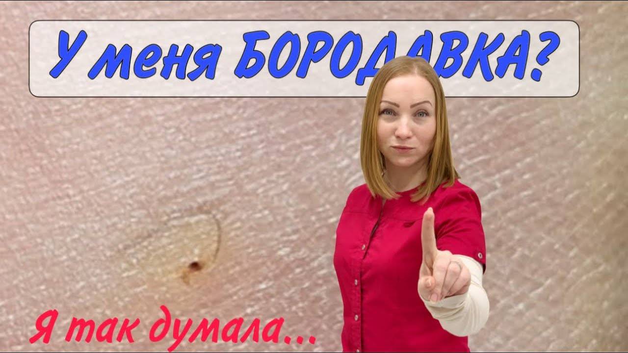 Вросший волос _ бородавка на ноге _ медицинский педикюр смотреть онлайн