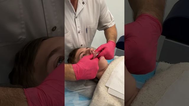 Миофасциальный синдром. смотреть онлайн