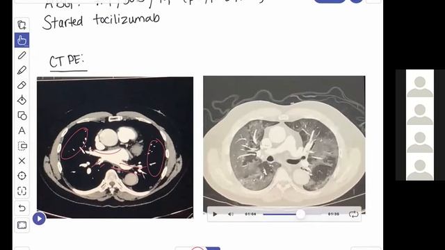 Zoom at Noon: ICU Conference смотреть онлайн