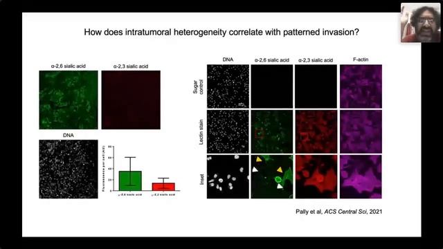 ACoM2021 Dr R.Bhat: Tracking causes & consequences of multicellular patterning in cancer progressio смотреть онлайн