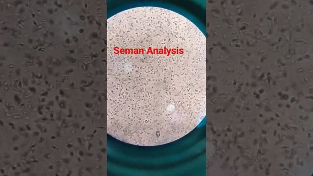 Semen Analysis смотреть онлайн