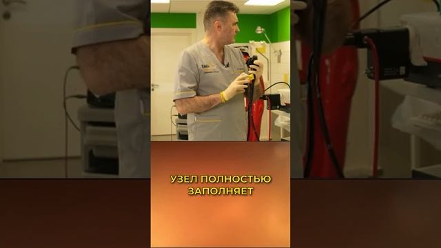 #эндоскопия #doctor #endoscopiadigestiva #лайфхаки #гастрит #лигирование