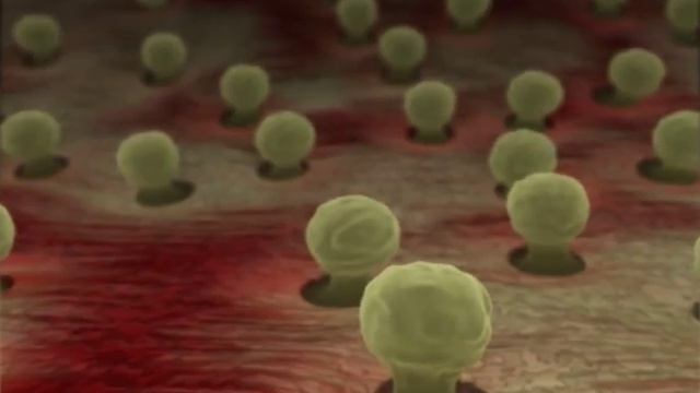 Johns Hopkins Medicine | Aplastic Anemia