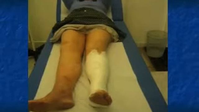 Dr Maxime CHAHIM -Bande à l'Oxyde de Zn . VAROLAST*-Phlébonews Société Française de Phlébologie смотреть онлайн