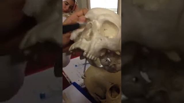 Cranial cavity 4-UOS Physiotherapists смотреть онлайн