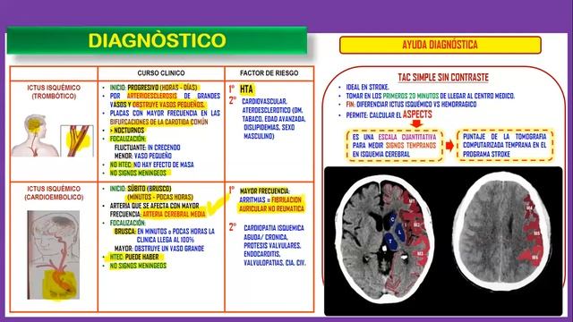 ✅MEDICINA - I 💥ENFERMEDAD CEREBRO VASCULAR 💛KEVIN HOWSER смотреть онлайн