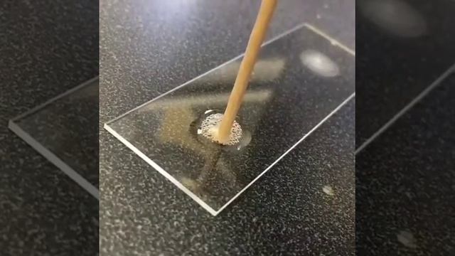 Pemeriksaan katalase pada bakteri смотреть онлайн