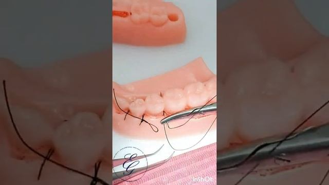 The suture technique/ Tikiş texnikası #3 / Техника наложения швов в полости рта. смотреть онлайн