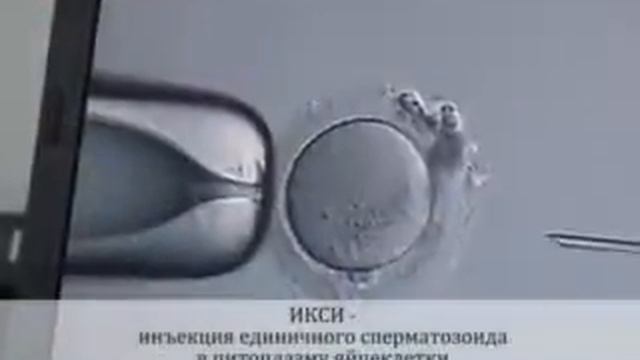 Ролик 8 ИКСИ смотреть онлайн