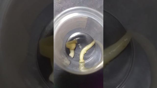 Adult Tapeworm segments(Taenia Saginata) смотреть онлайн