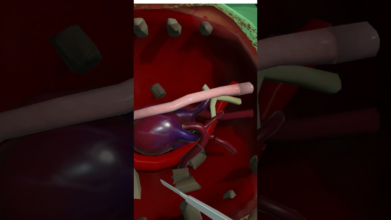 402 Режь синий Surgeon Simulator Лучшее, Shorts смотреть онлайн