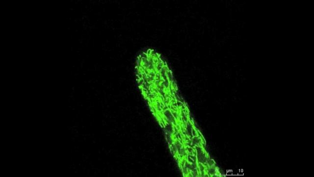 Neurospora Organelle Structure.mov