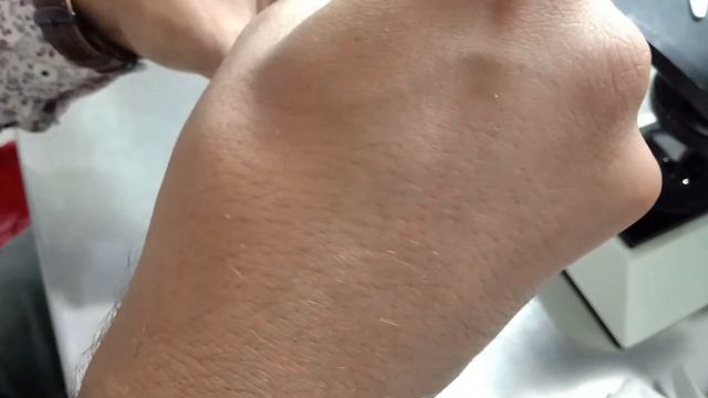 Double Density Gradient Procedure || IUI Sample || IVF Video|| смотреть онлайн