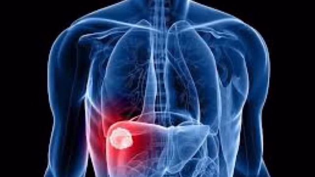 Գաստրիտ смотреть онлайн