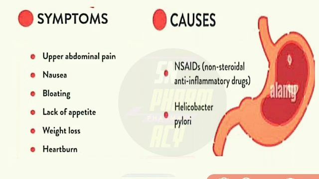 Rebagen Tablet Use , Mouth, Peptic Ulcer|| Peptic ulcer treatment @SNPharmacy смотреть онлайн