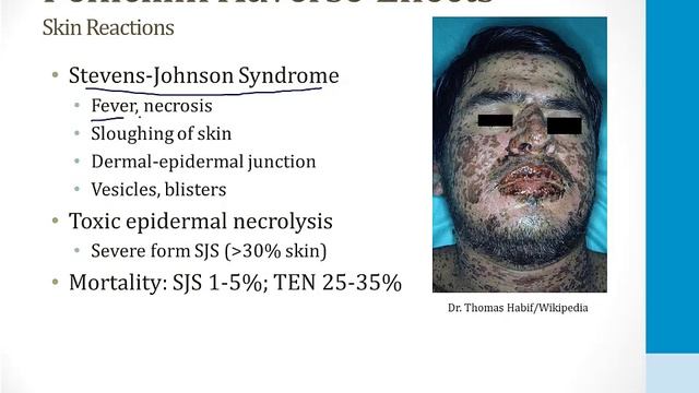 Infectious Diseases - 3. Antibiotics - 1.Penicillins Atf