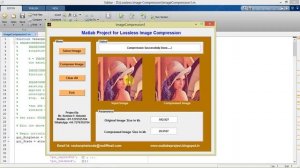 Lossless Image Compression Matlab Project | Medical Image Compression Using Matlab