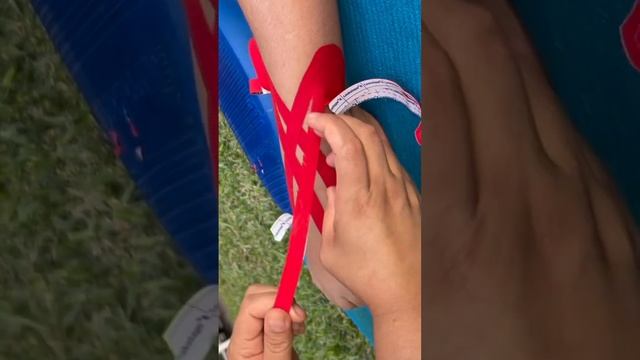 Kinesiotaping: técnica de drenaje linfático. смотреть онлайн