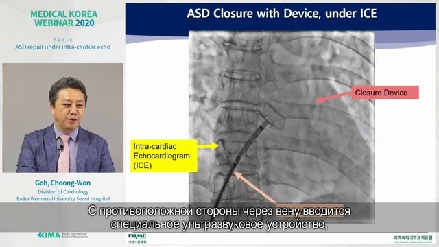 (Russian)ASD repair under intra-cardiac echo_EWHA WOMANS UNIVERSITY MEDICAL CENTER смотреть онлайн