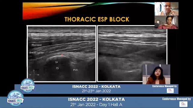 ESP (erector spinae plane), TLIP(thoracolumbar interfascial plane) AND QL BLOCKS смотреть онлайн