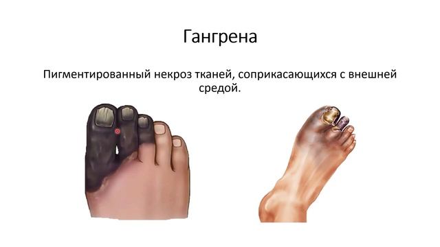 Лекция 1. Некроз и апоптоз смотреть онлайн