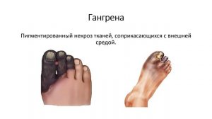 Лекция 1. Некроз и апоптоз