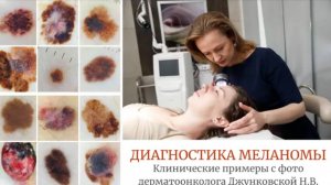 Диагностика меланомы. Клинические примеры с фото.