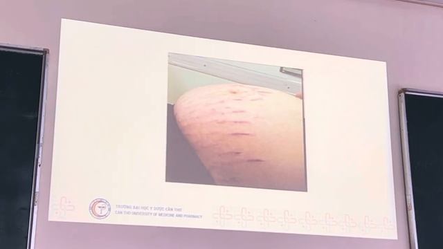 PHỤ SẢN CTUMP: THAY ĐỔI GIẢI PHẪU - SINH LÝ Ở PHỤ NỮ KHI MANG THAI | BsCKI. Võ Thị Ánh Trinh смотреть онлайн