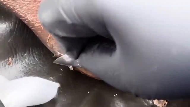 Джиггеры Тунгиоз поражение ног.