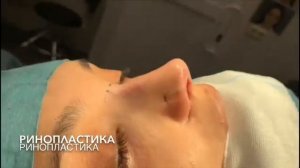 Ринопластика. Операционная. Жолтиков В.В.