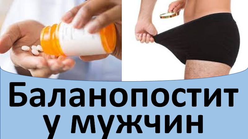 Баланопостит у мужчин лечение смотреть онлайн