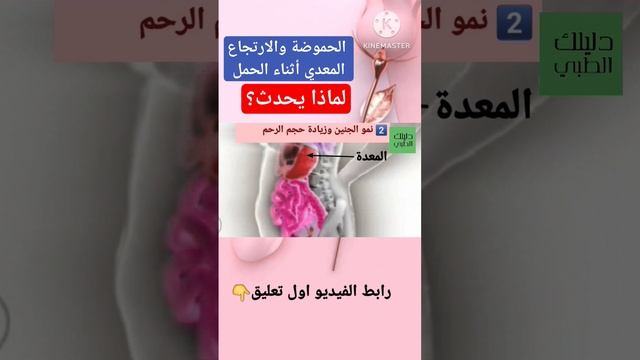 الحموضة والارتجاع المعدي أثناء الحمل/لماذا يحدث؟ смотреть онлайн