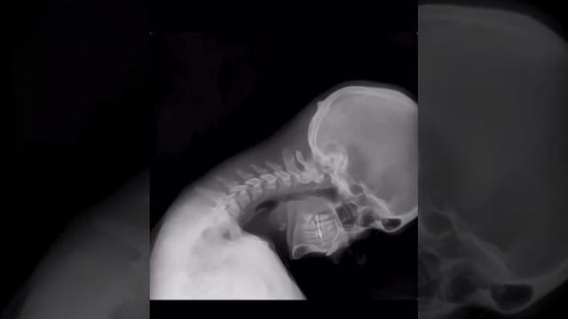 Así Se Ven Los Huesos #viral #anatomy #quiromasajesfyj