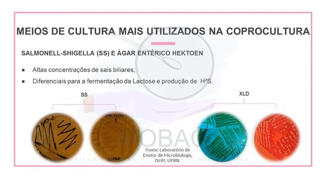 Diagnóstico Laboratorial das Gastroenterites causadas por Enterobactérias смотреть онлайн